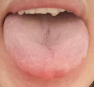 阳气不足身体发凉？中医调理心得分享







很多男同志一旦出现了行事时长短