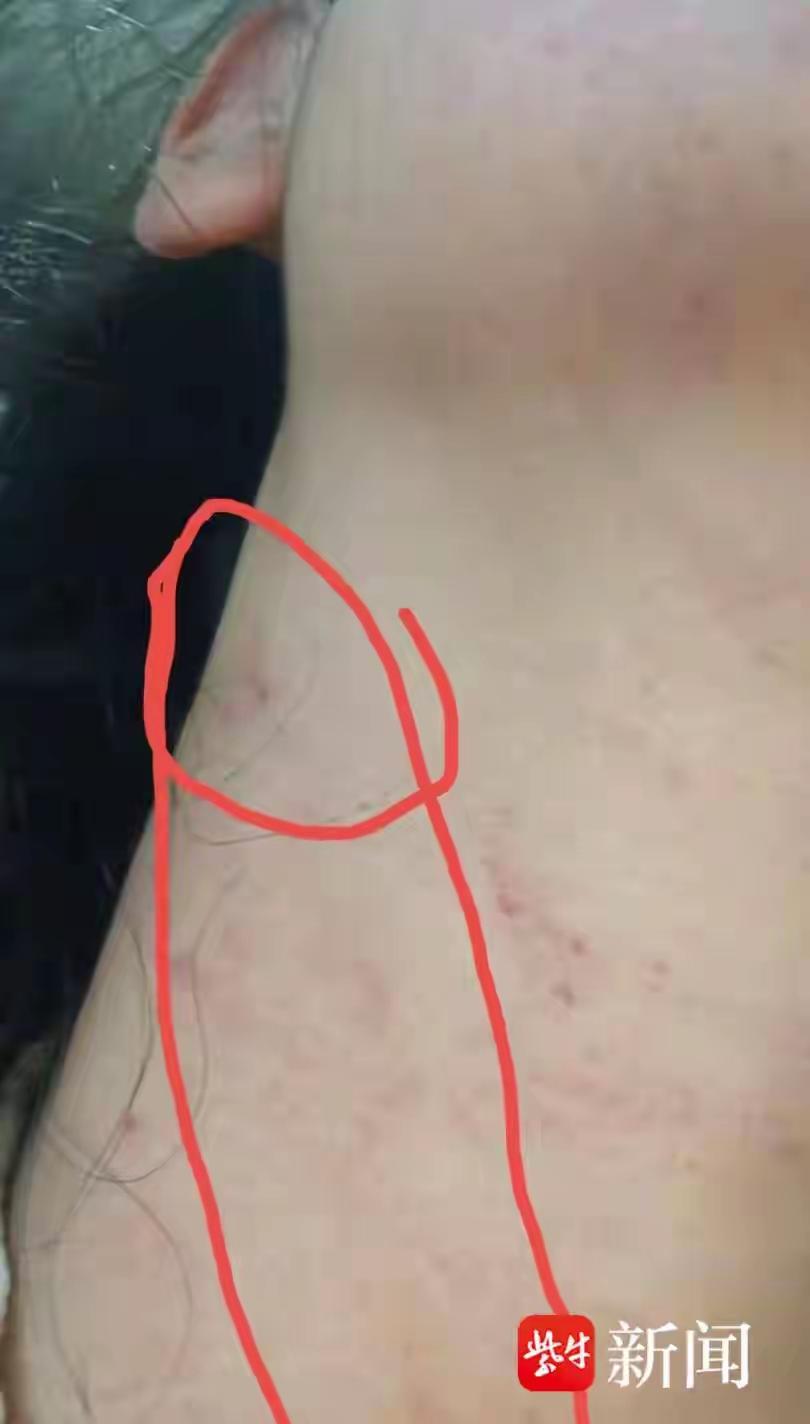 “女子遭家暴致半身不遂案”将开庭，当事女子发声

这是一场令人心碎又令人愤怒的家