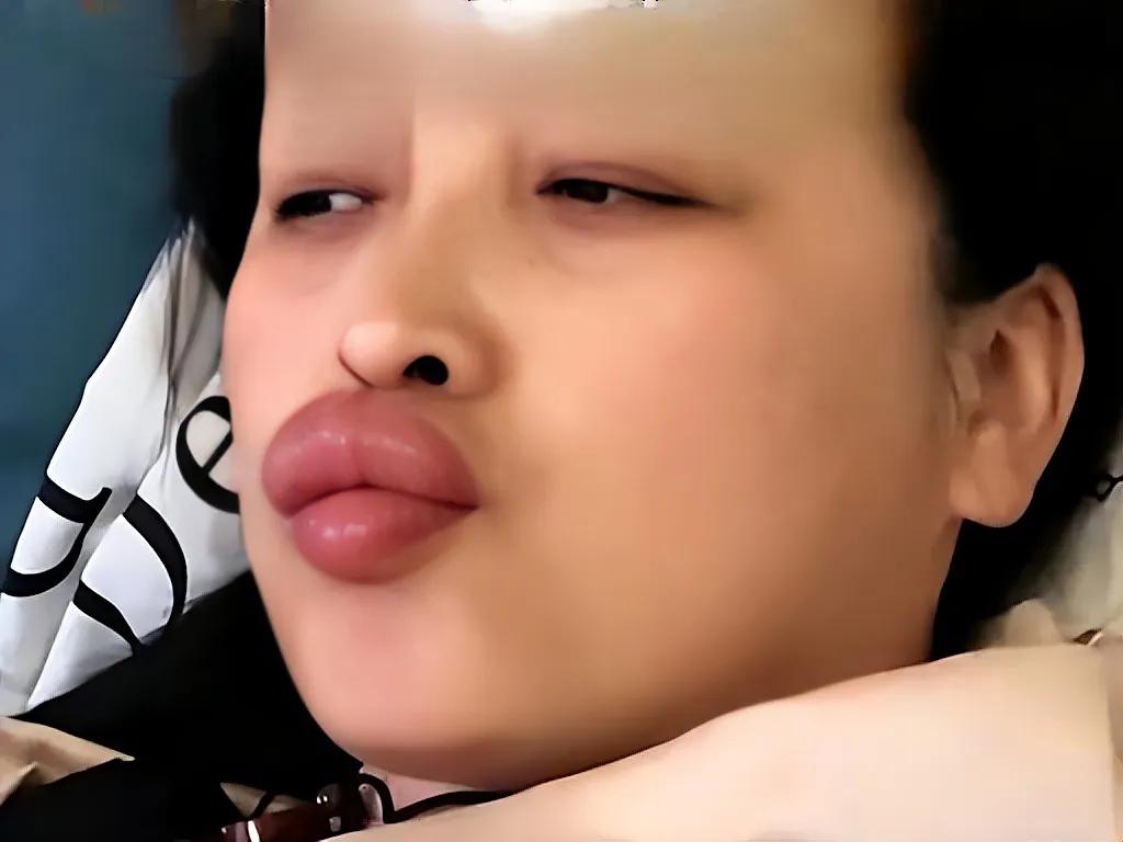 不听劝阻亲宝宝脚丫，姥姥嘴唇为啥肿成香肠？
劝了八百遍别亲宝宝脚丫，非不听！这下