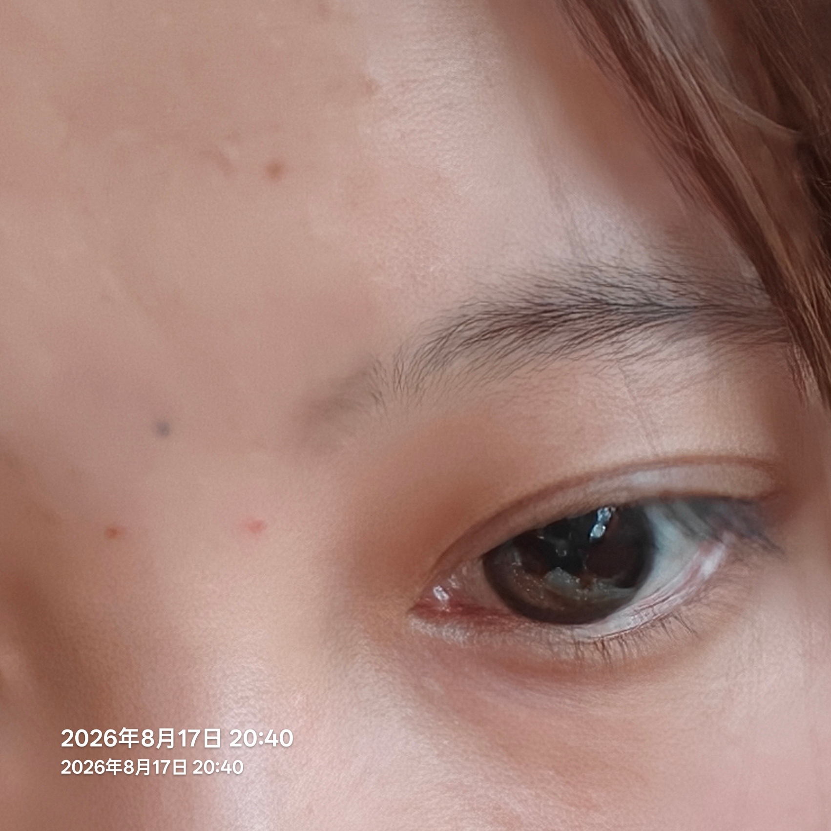 哈哈哈哈哈哈我这个是眉心有个∴ 