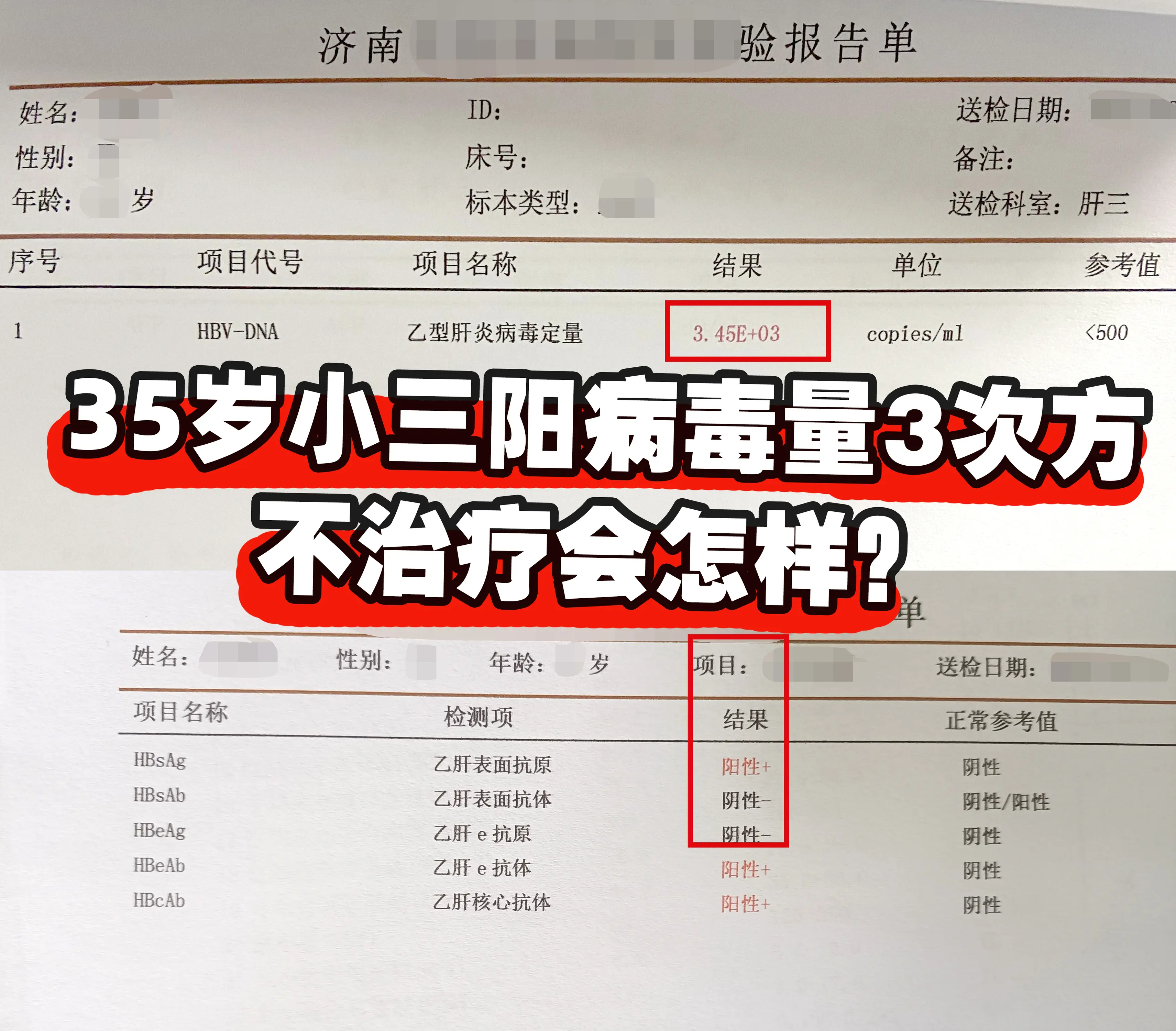 ①乙肝具有传染性，不治疗可能增加病毒传播的风险。 ②乙肝长期不治疗可能...