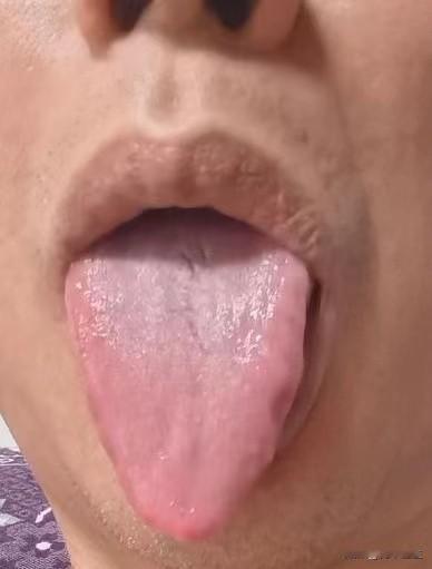 晚上睡不着，还容易醒，这可能是你的肝脏出问题了，别不上心

主诉：口干舌燥，失眠