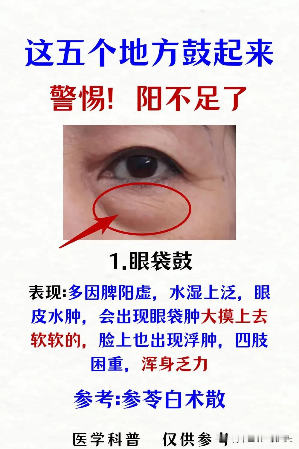 这五个地方鼓起来，警惕！阳不足了！#肾虚# #健康养生# #肾阳虚#
