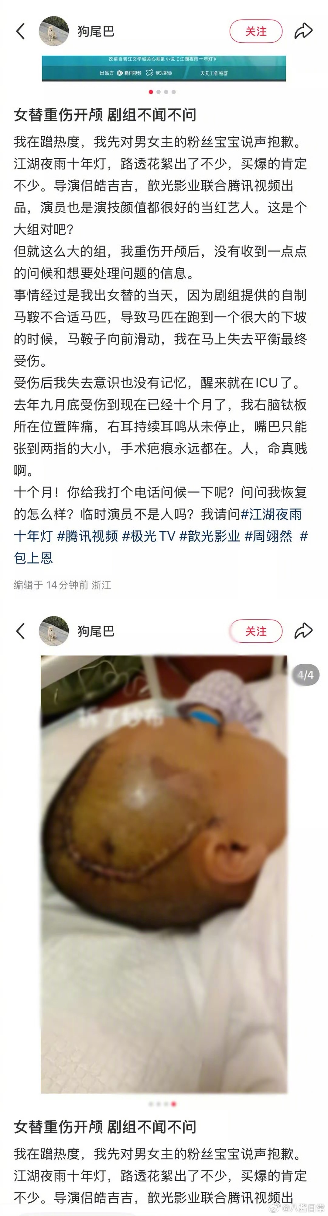 女替身演员发文称拍戏时坠马重伤开颅，剧组不闻不问 ​​​