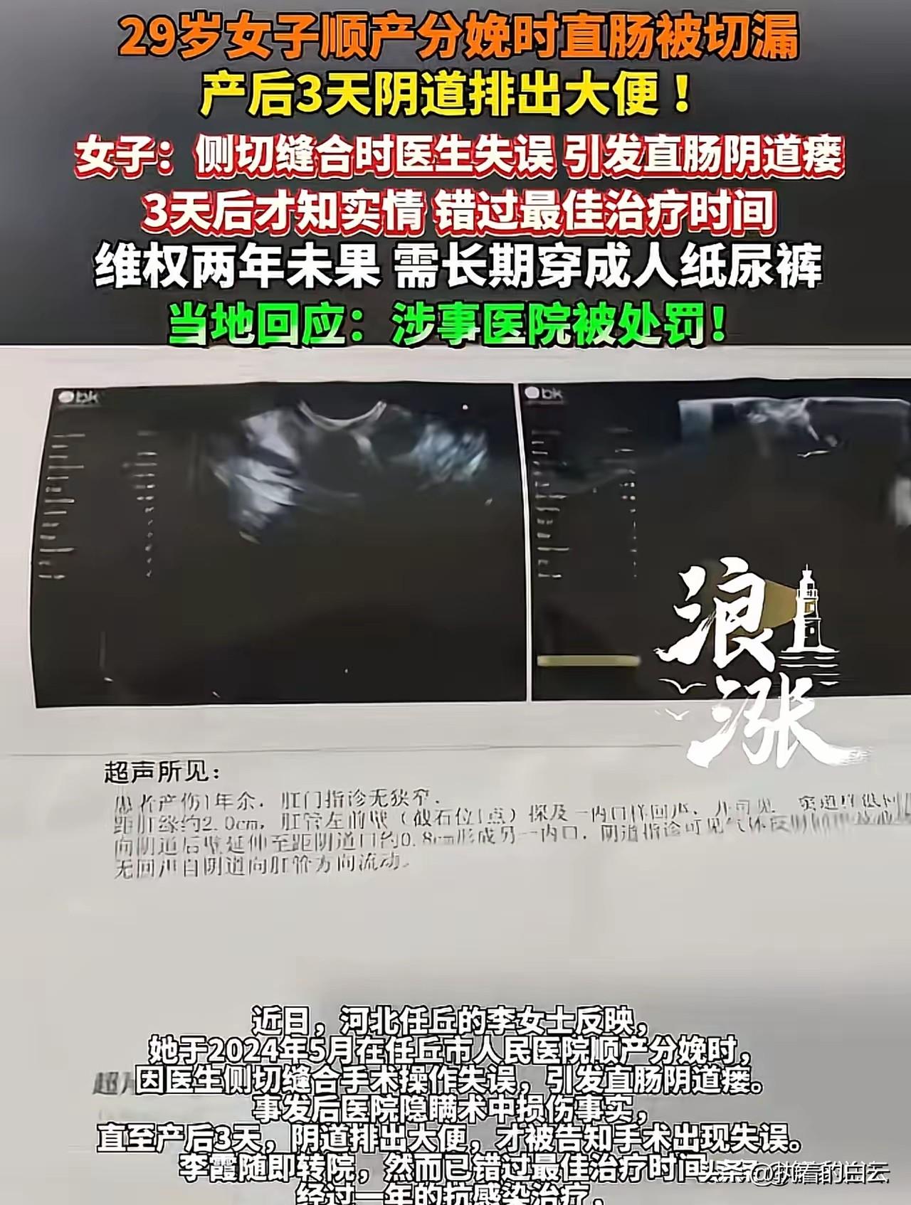 太惨了！29岁妈妈顺产，结果直肠被缝漏了？产后3天阴道拉出大便！

生孩子是走一