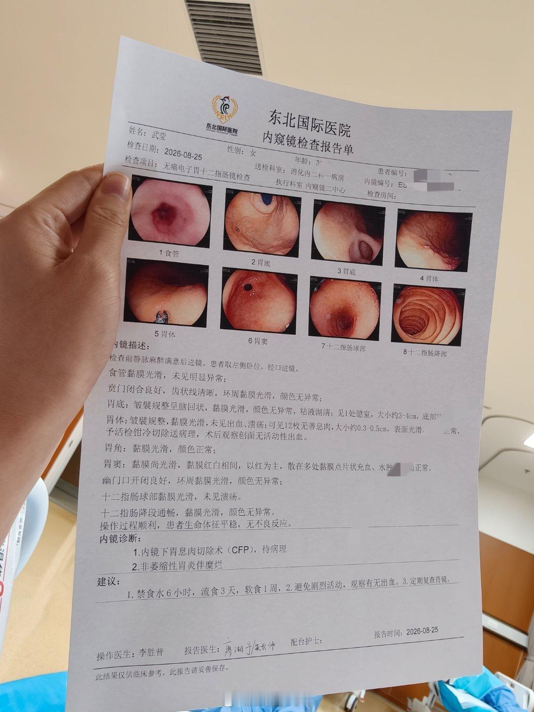 肠镜啥事没有，12 个胃息肉，已摘除！ 