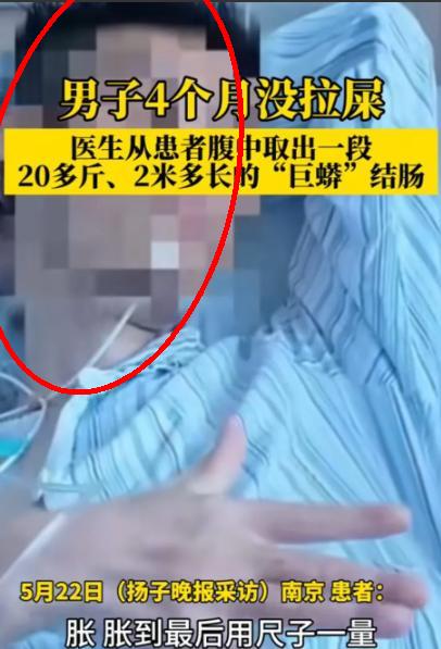 一名男子4个月没拉屎，憋到不行，只能去医院
医生划开他肚子的瞬间，弹出来的肠子把