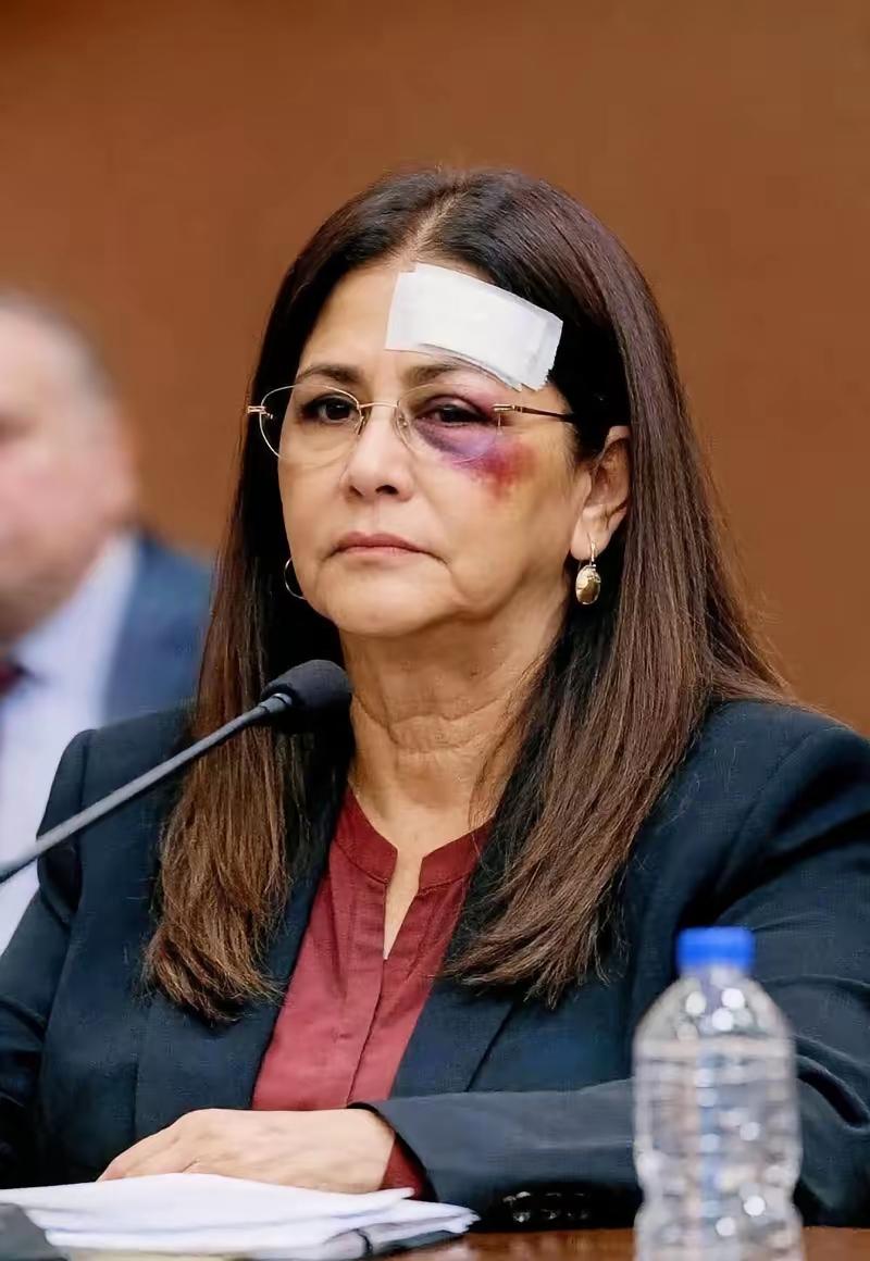 这就是所谓的人权国家美国，


委内瑞拉总统马杜罗妻子肯定是这么认为的……