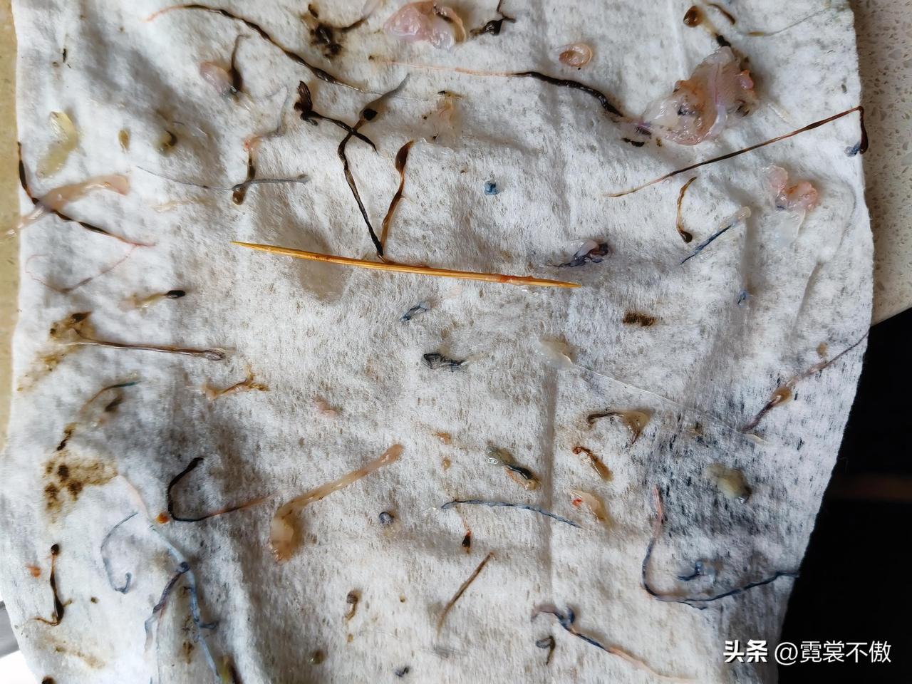 发现一个新问题：一般虾线是在背上吧，今天发现肚子底下还有一根黑线。老头子是学生物
