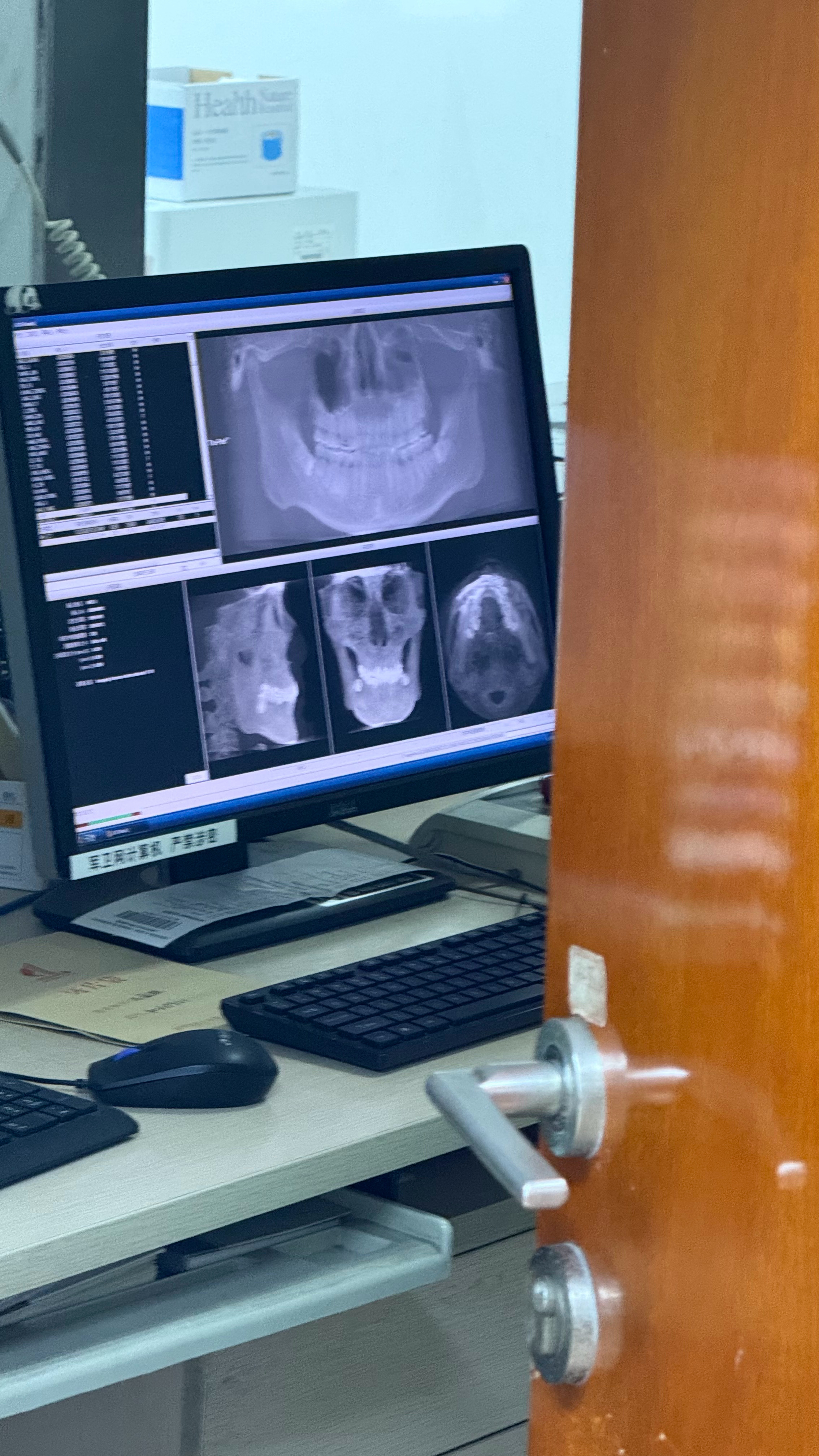 这牙科CT看着太喜感了