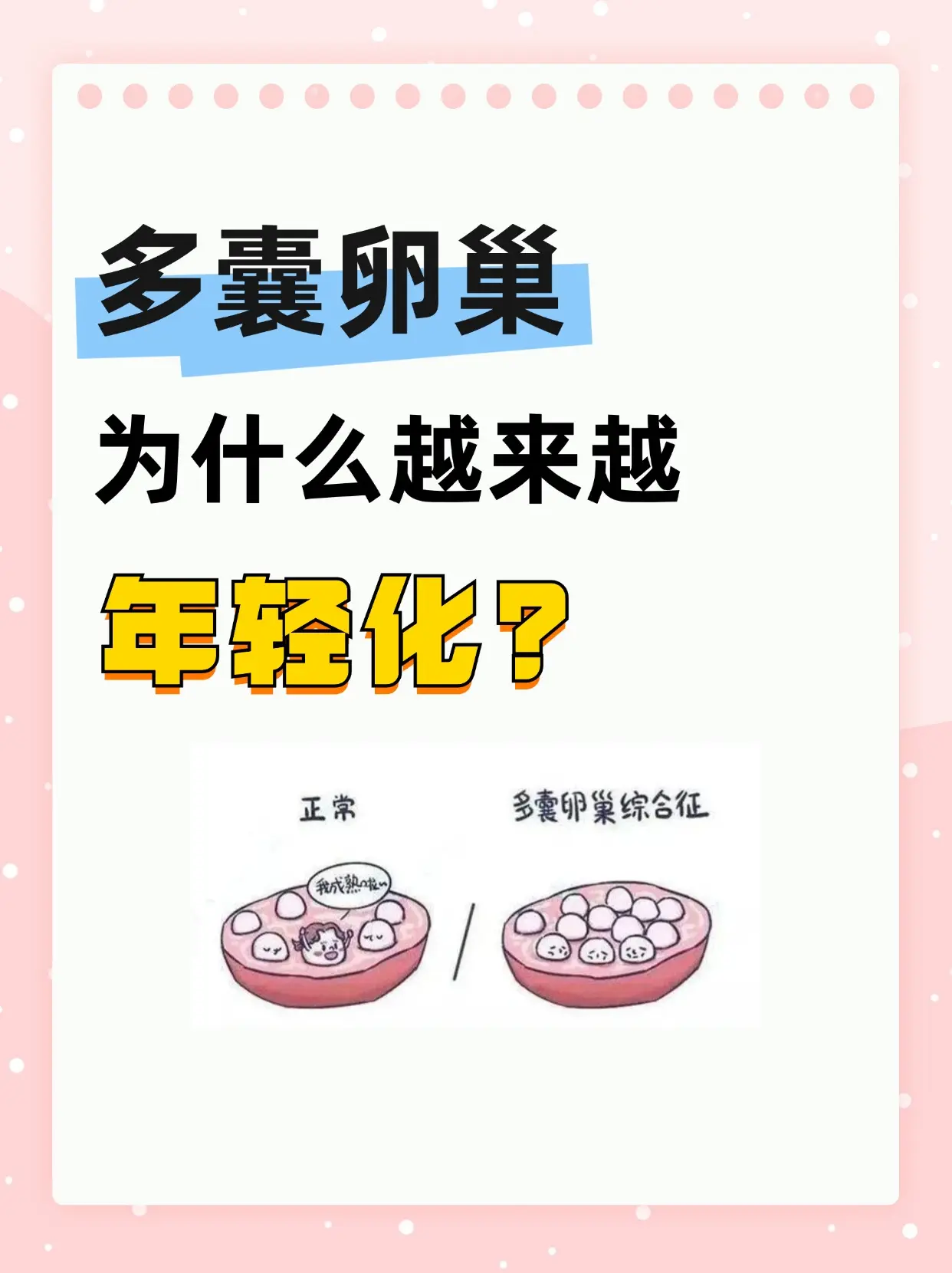 多囊为什么越来越年轻化？。