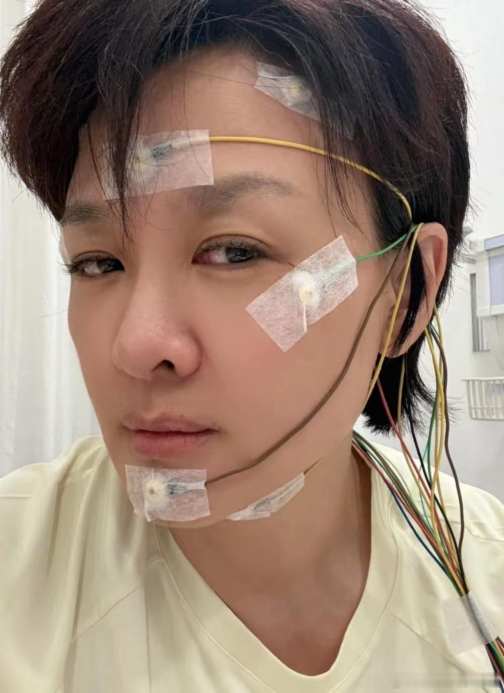央视知名主持人李小萌在最新动态中分享自己近况，连续25年失眠，出现脑雾，全身插满