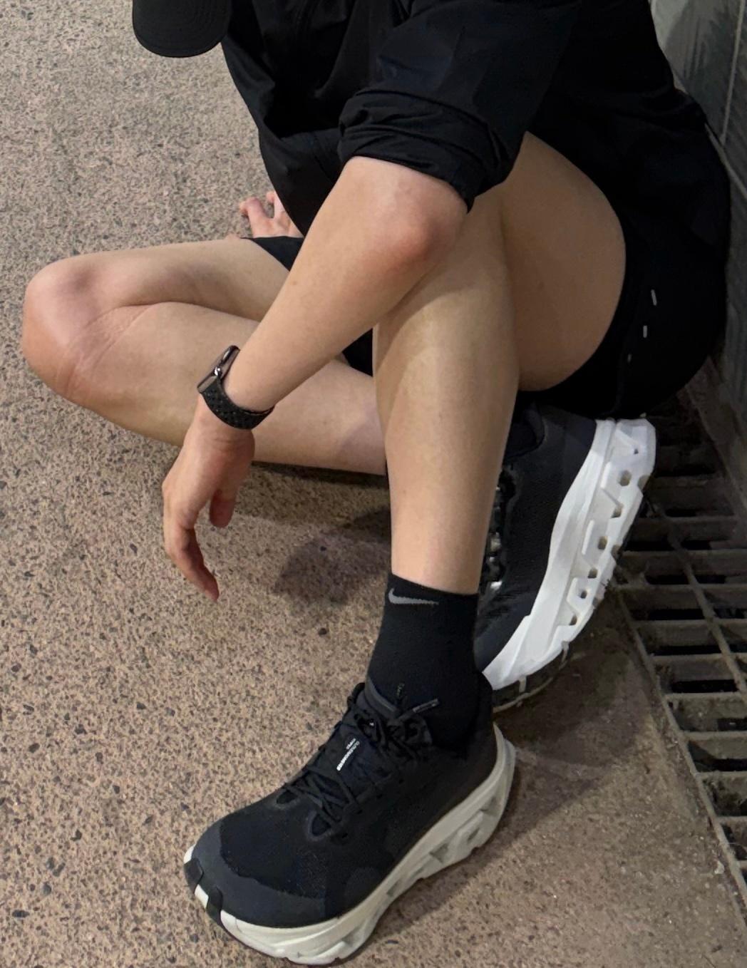 粉色手肘 蜜大腿 髌骨带的勒痕 脚踝 ​​​