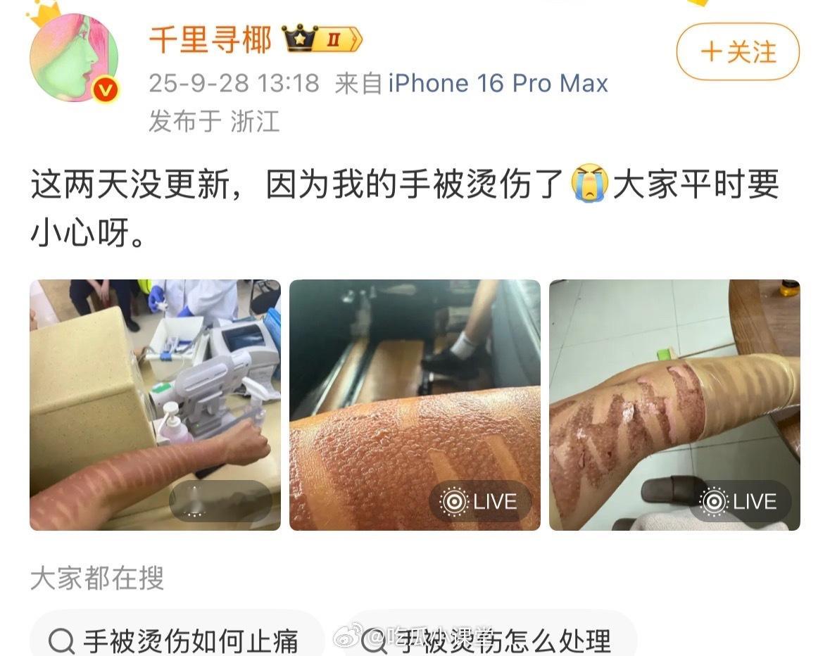 千里寻椰 光子嫩肤二度烧伤.深二度烧伤可能留疤一辈子…就做个普通光子嫩肤而已啊！