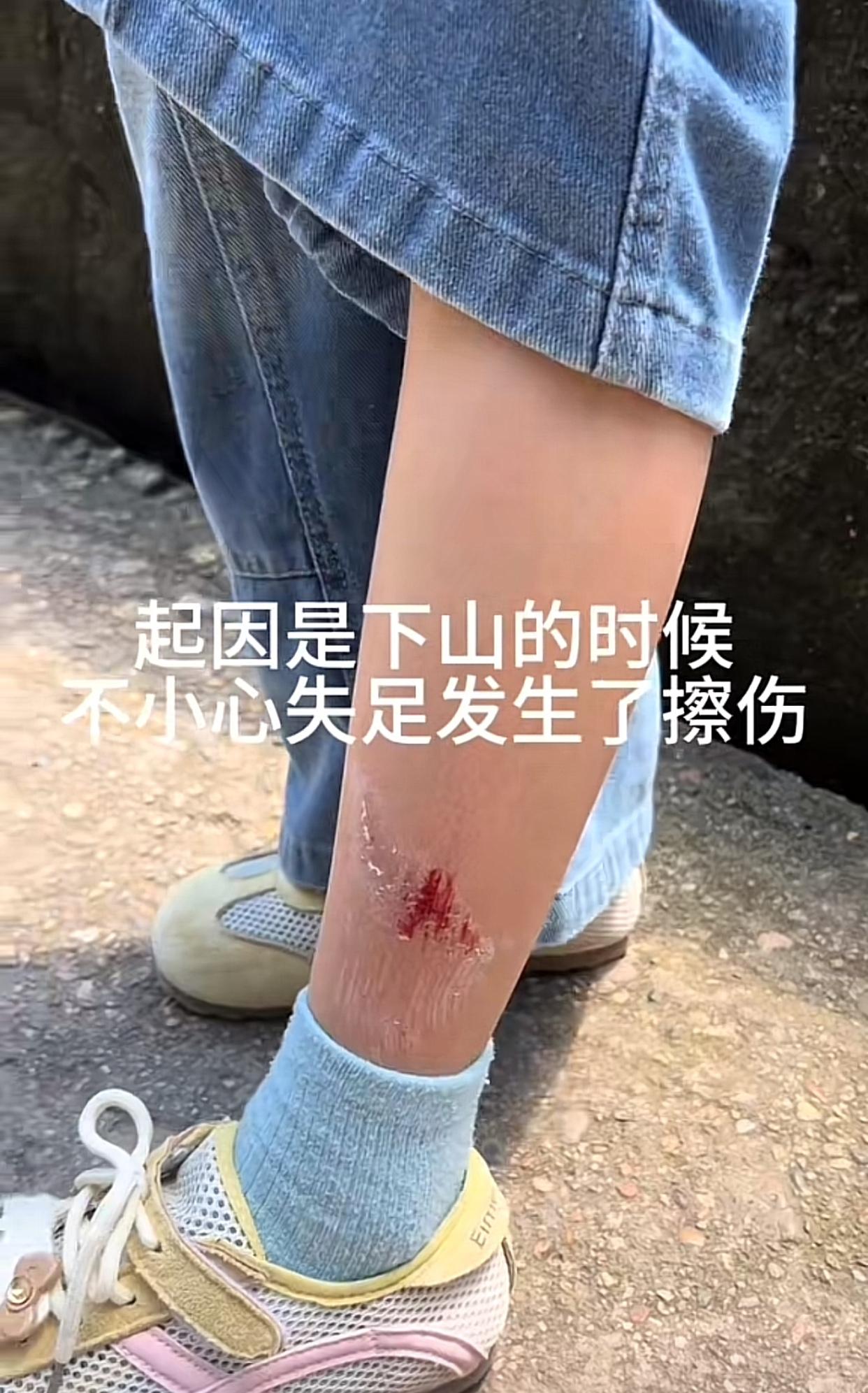 近日江西上饶，一位女网友带着孩子在某景区内游玩，在下山途中孩子不慎失足腿部擦伤，