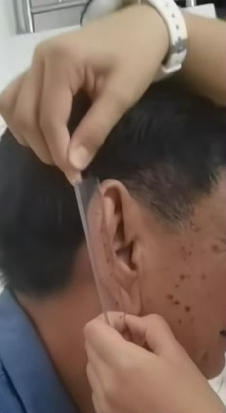 9厘米的大耳朵，你有吗？快量一下你的耳朵有多长。 