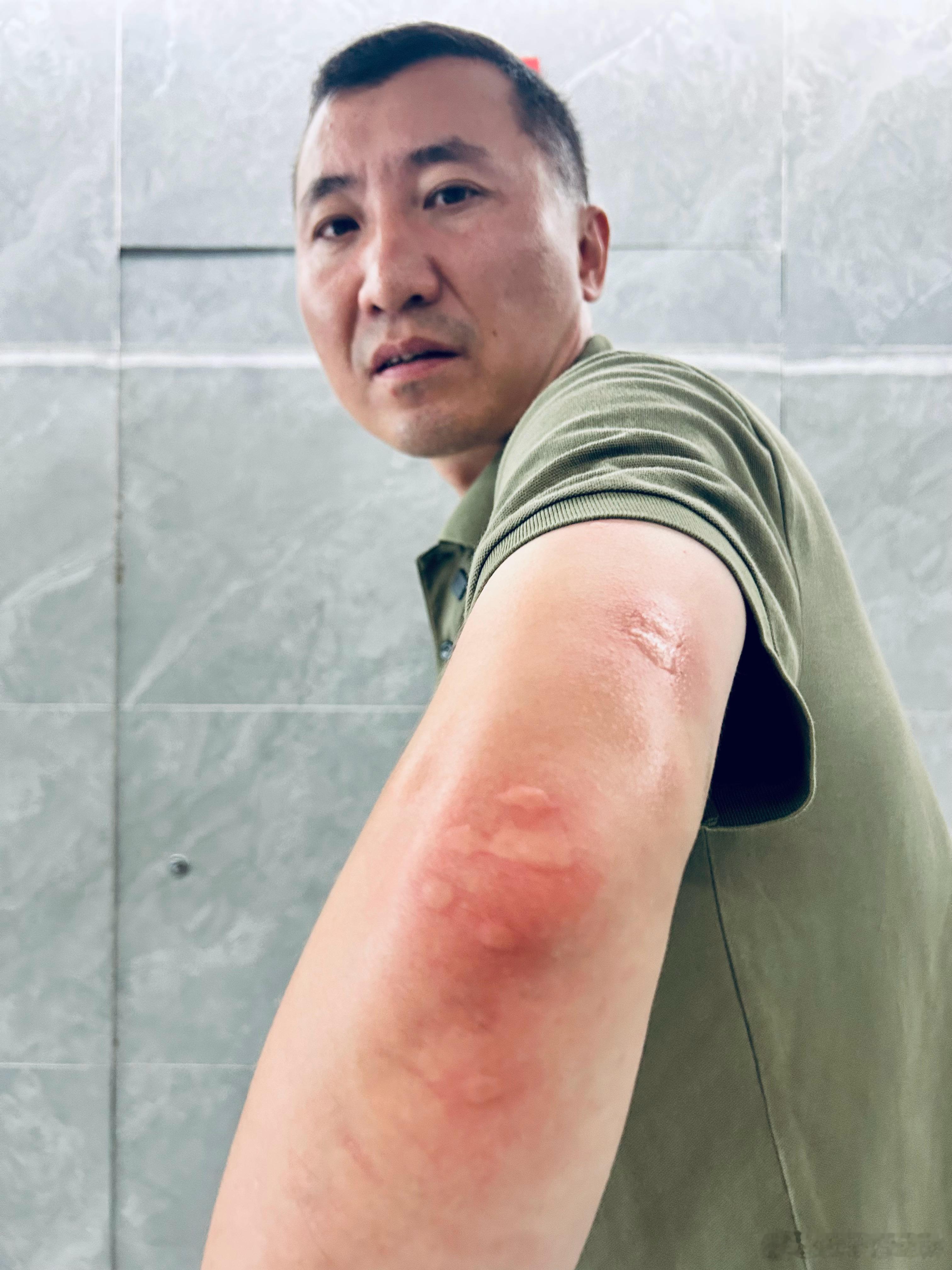 四川绵阳的蚊虫那是相当~给力~~~ ​​​