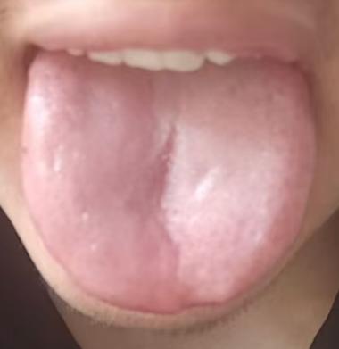 男性体虚调理难？一方滋补肝肾，重拾身心好状态






有不少伤精多年的朋友问