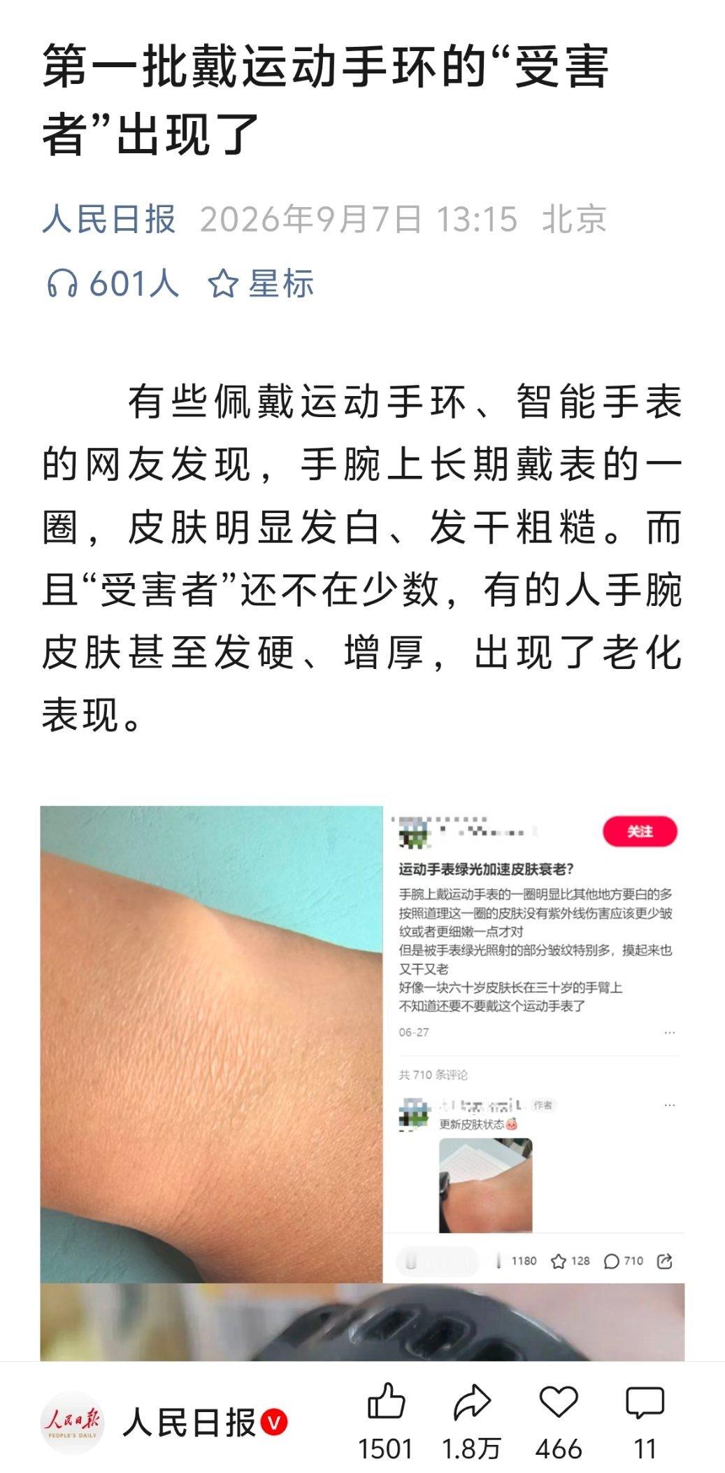 【官方权威科普：运动手环损害手腕皮肤健康？绿光照射危害皮肤？】现在运动手环，智能