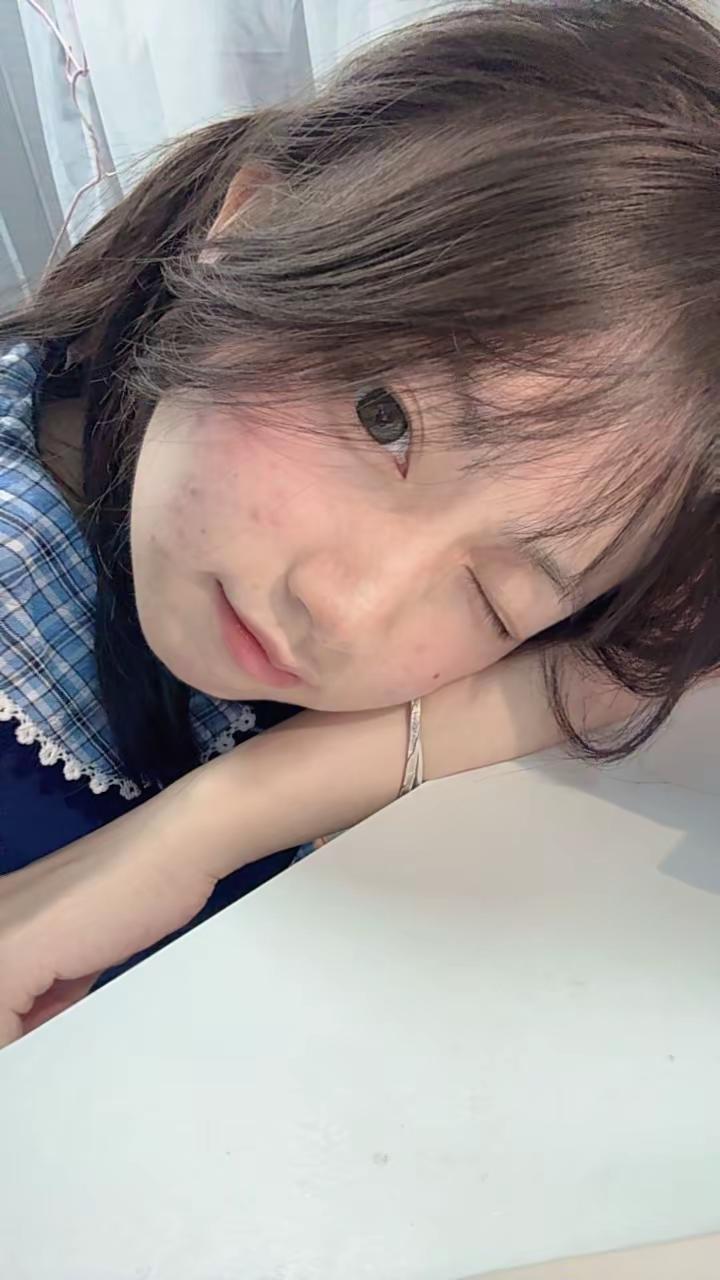 登陆我的视角迷之角度girl 爆痘 皮肤