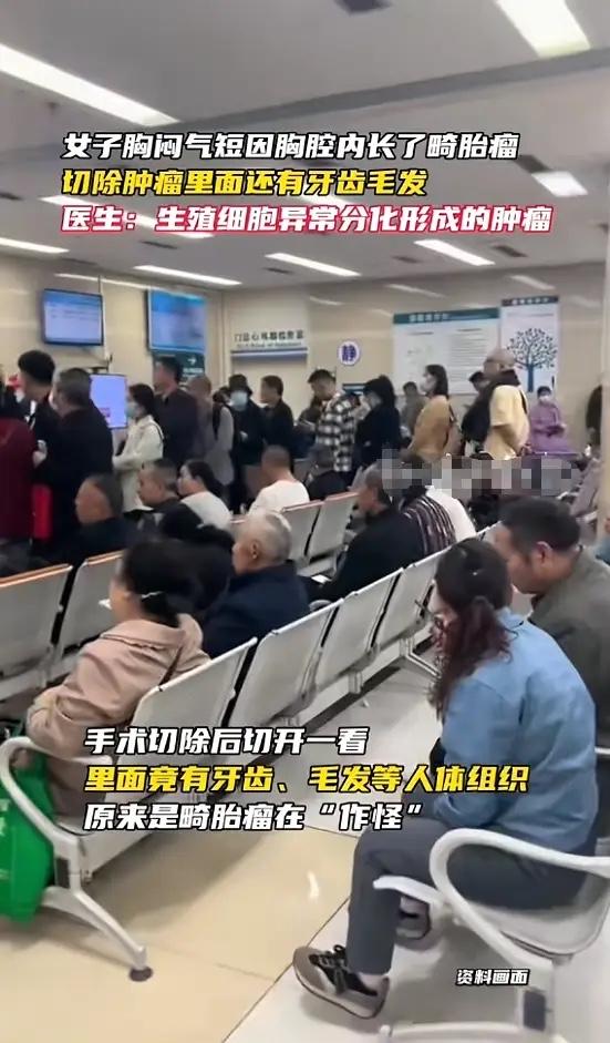 “活久见！”近日，杭州萧山，一女子身体一直不错，可前段时间，她感觉莫名胸闷，随着