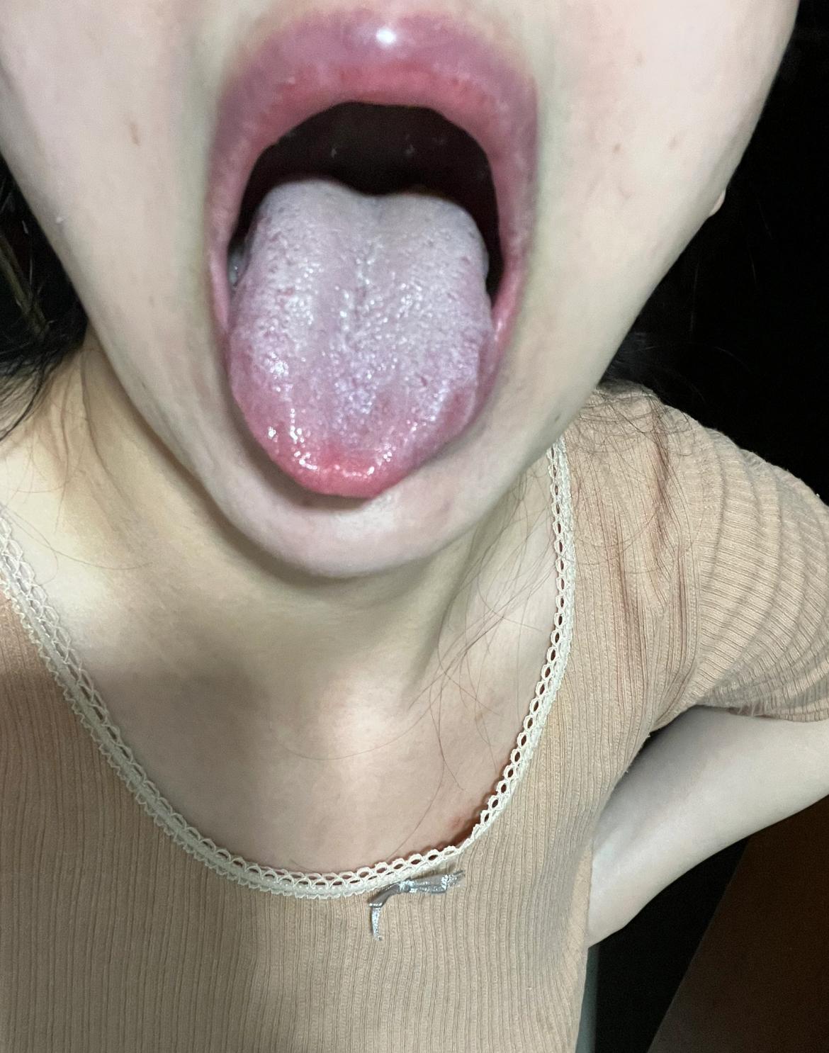 姑娘都31岁了，听点话吧！你想让我怎么说呢！
逍遥丸你也试过了，参苓白术散你也试
