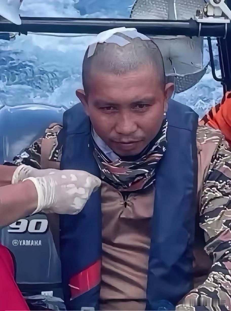 这二蛋（菲律宾军人）在南海骚扰捣乱时，被咱们海警敲破头皮的主，菲国内个别人称他为