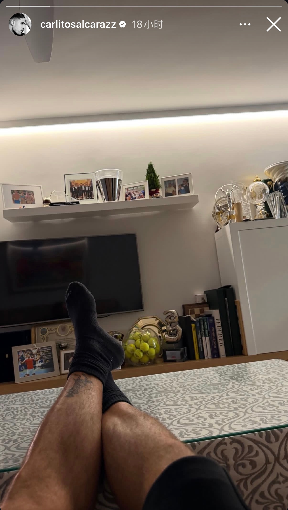 来考一下大家的新媒体网感你会给阿卡发的这个图起个什么标题？✍ 阿尔卡拉斯劳伦斯最