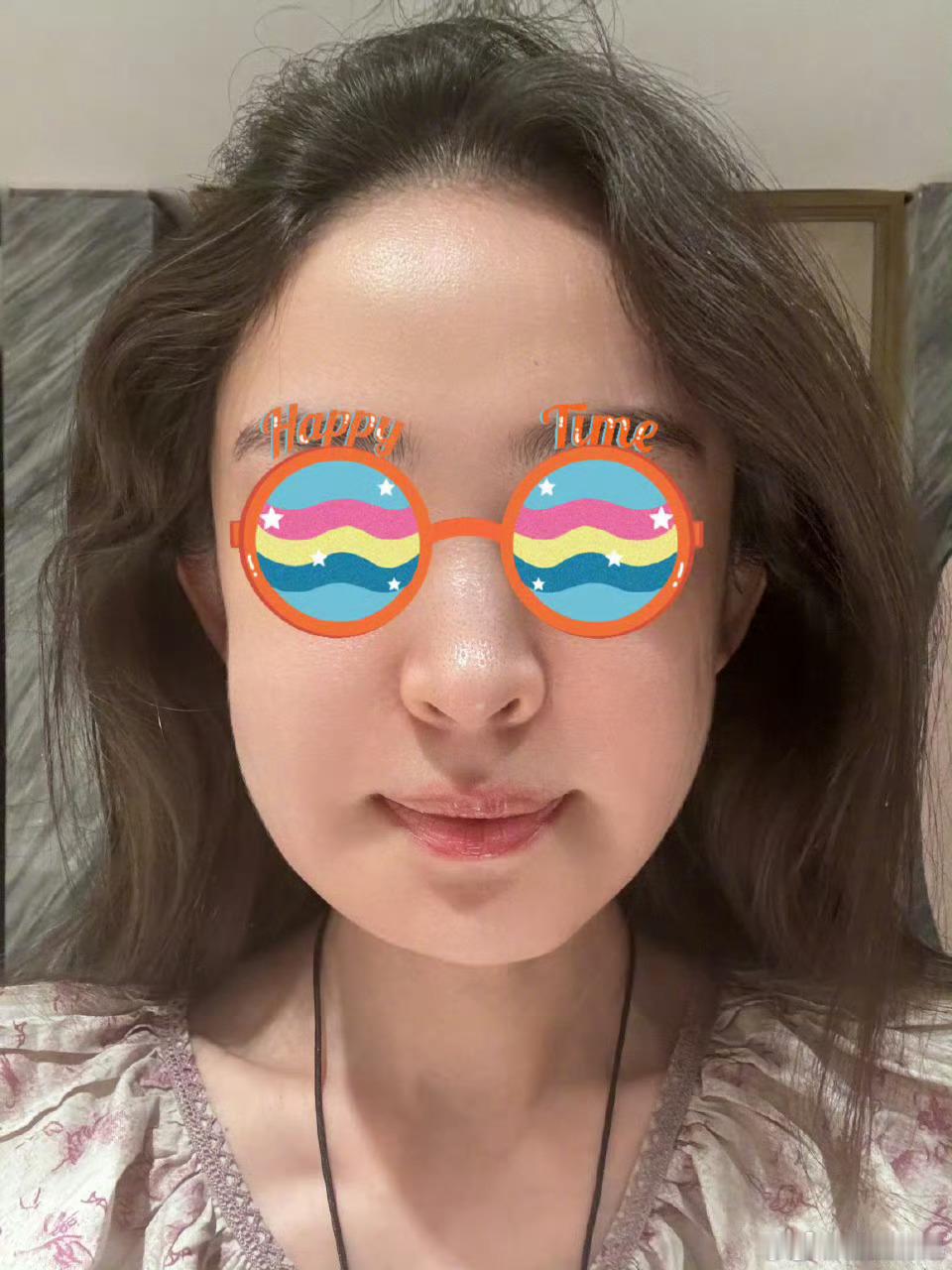 娜扎肿成蜜蜂小狗怎么能肿成这样还是很美啊！！！！我真服了[老师好] ​​​
