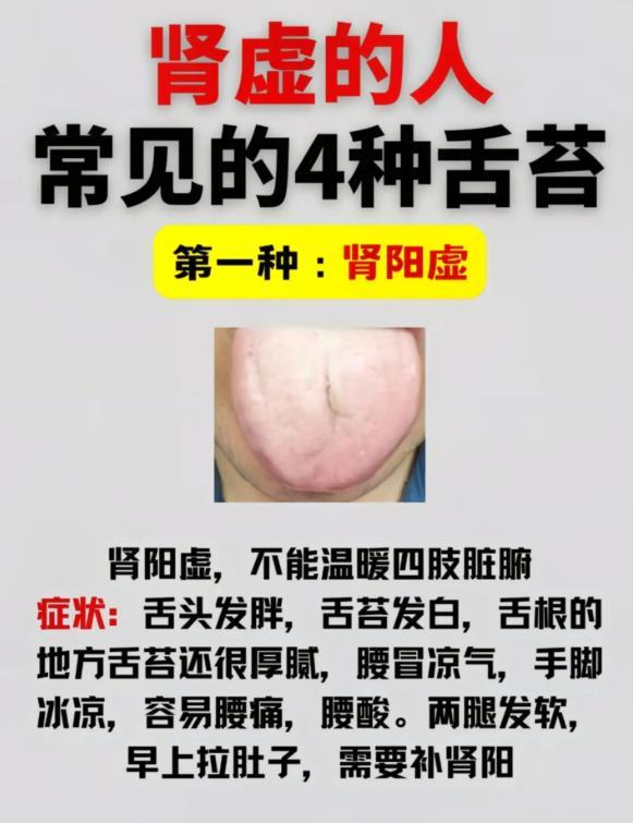 看舌辨肾虚，4 种舌苔信号