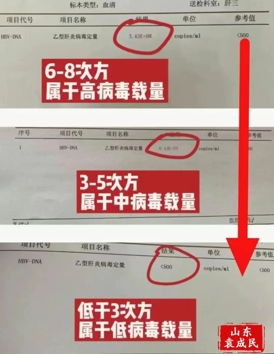乙肝病毒量多少才算高？