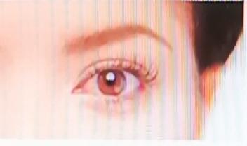 玻璃体混浊和飞虫现象（飞蚊症）可不一样。飞蚊症是症状，玻璃体混浊是体征。
从病因