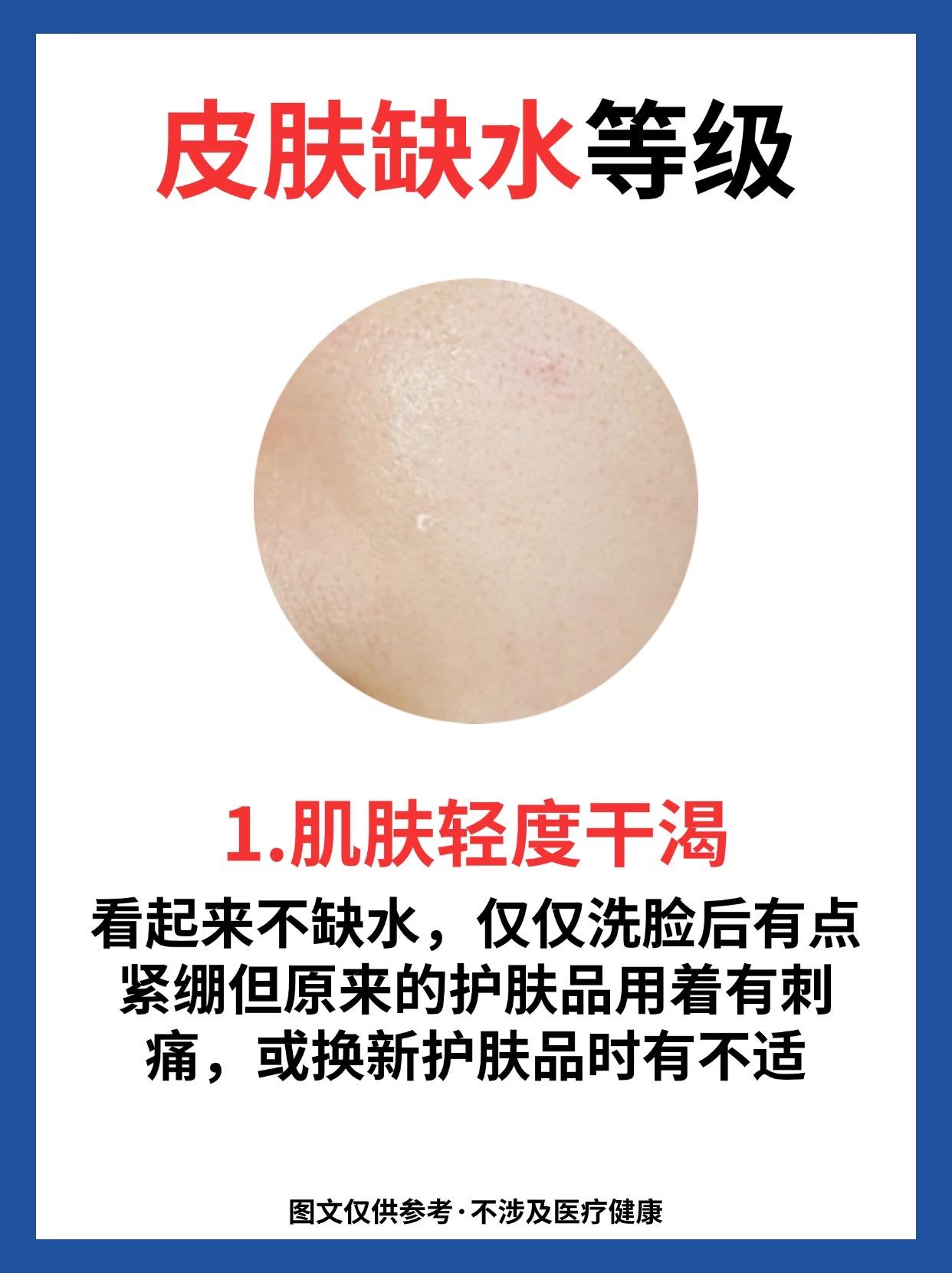 秋季皮肤缺水。