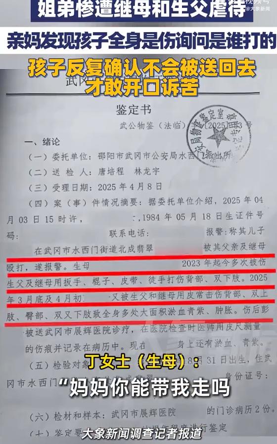 遭虐待男童反复说妈妈你能带我走吗？看到这样的新闻，总是让人痛心疾首。5岁男童身上