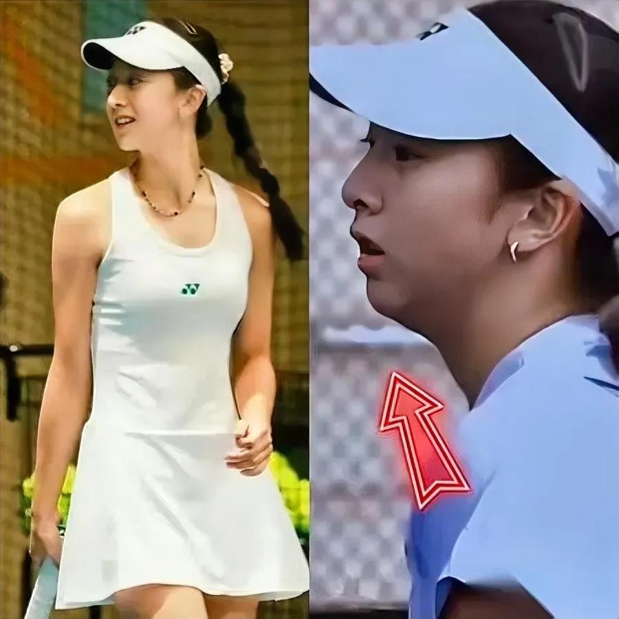 惊！森碟下巴咋变长了？

以前只知道隆鼻割双眼皮，这回被森碟下巴整懵了。最近看她