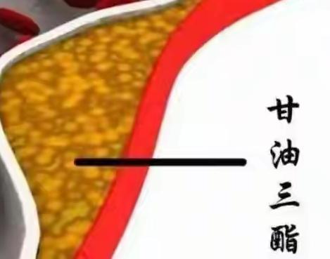 血脂高必须吃他汀类药物吗？

       今天去医院取体检报告，其它指标还都可