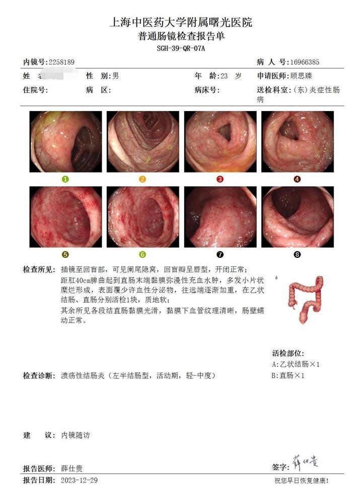 病程越短的溃疡性结肠炎修复越快。