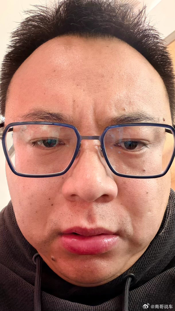 我现在发烧了但是我必须吃了这顿牛肉火锅因为不吃我估计扛不住 