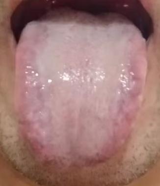 齿痕舌兼有心悸盗汗腰膝酸软，调理切勿单一补肾，根源多为心脾气血不足





