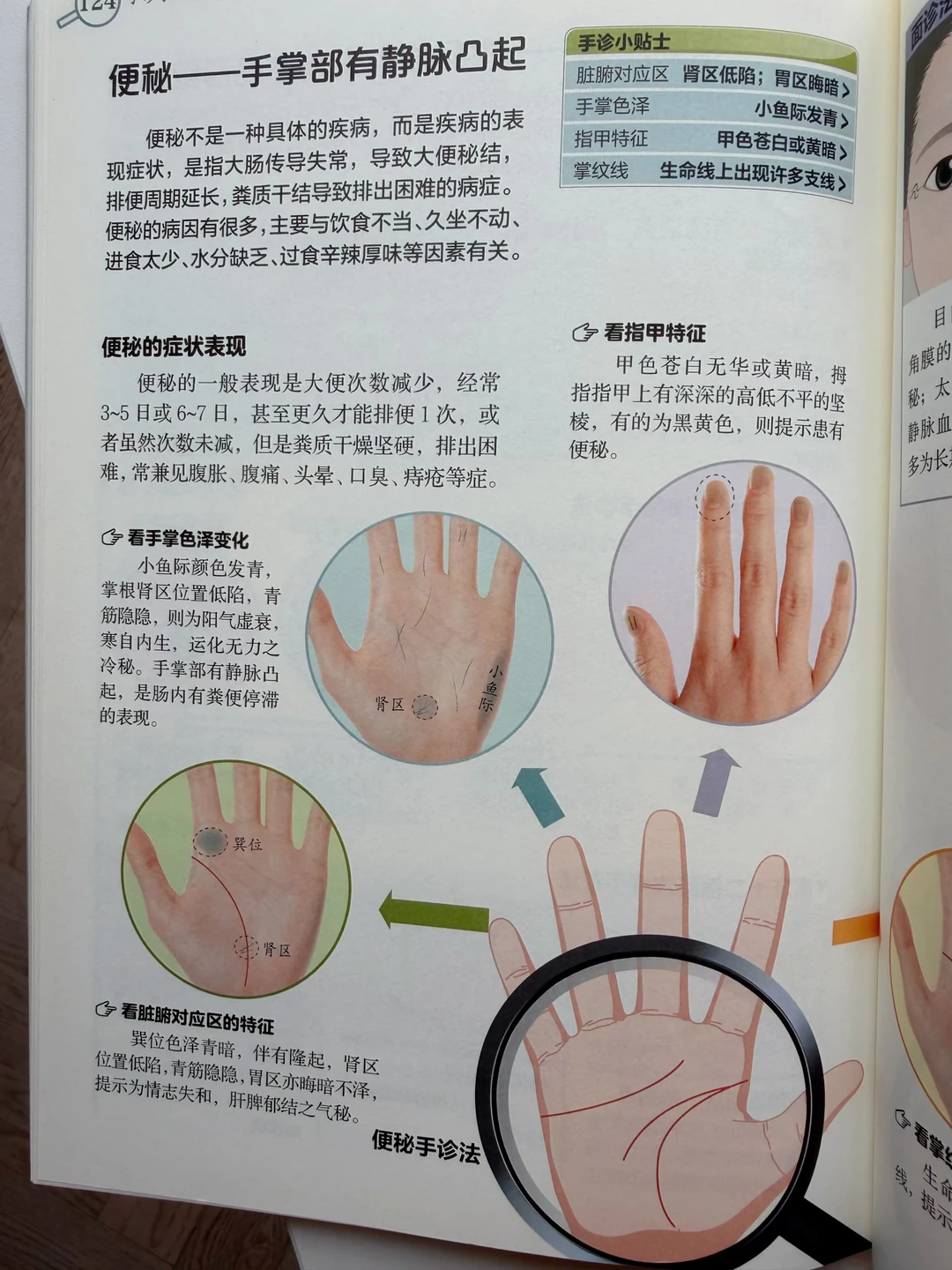 便秘，手掌部有静脉凸起