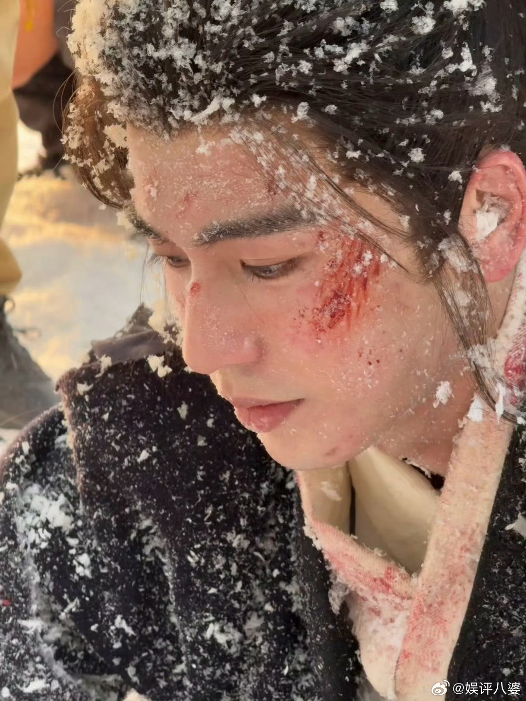 “在受伤，刚受伤，又要受伤”这总结简直神了😆 谢征小可怜总在受伤。大家都别欺负