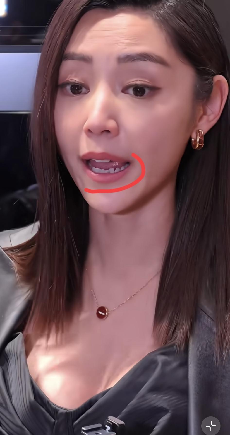 港星真的接地气。
你看卫诗雅牙齿，要是在内娱又得被喊去弄烤瓷牙了。
因为在内娱，
