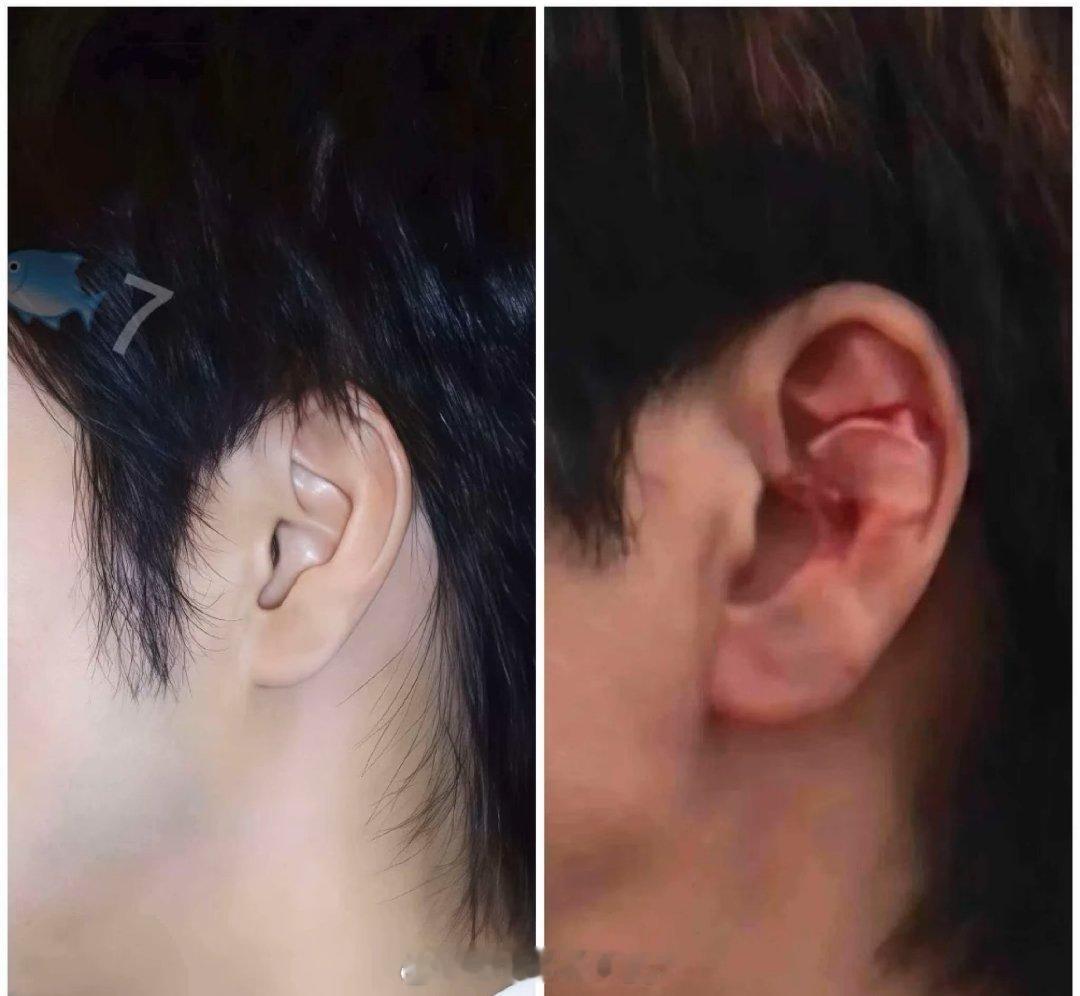 王力宏摔倒哥还是太敬业了。但是如果是在舞台上摔倒的话，还是要仔细的消毒处理一下伤