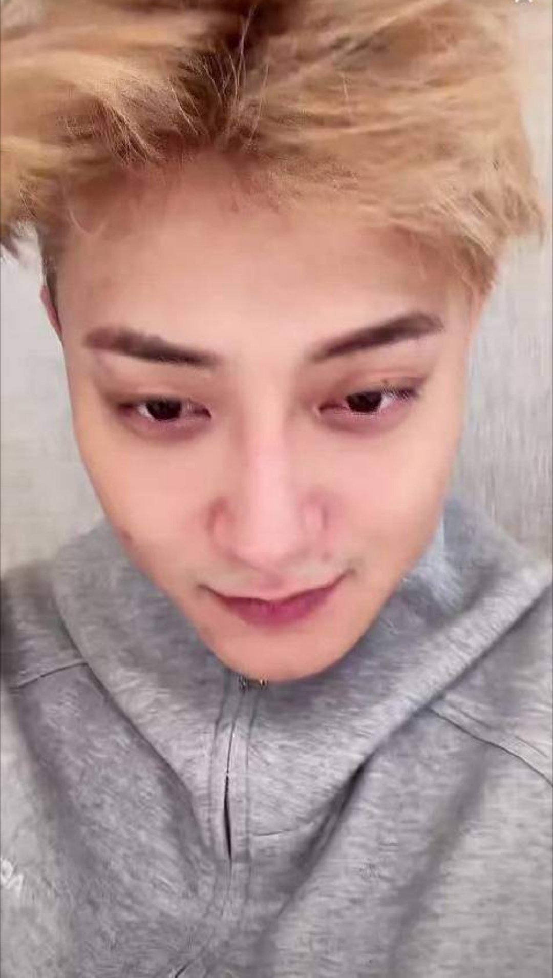 黄子韬脸上长了十二颗痘黄子韬的脸开启“痘”力全开模式！十二颗痘痘组团报到，自带真