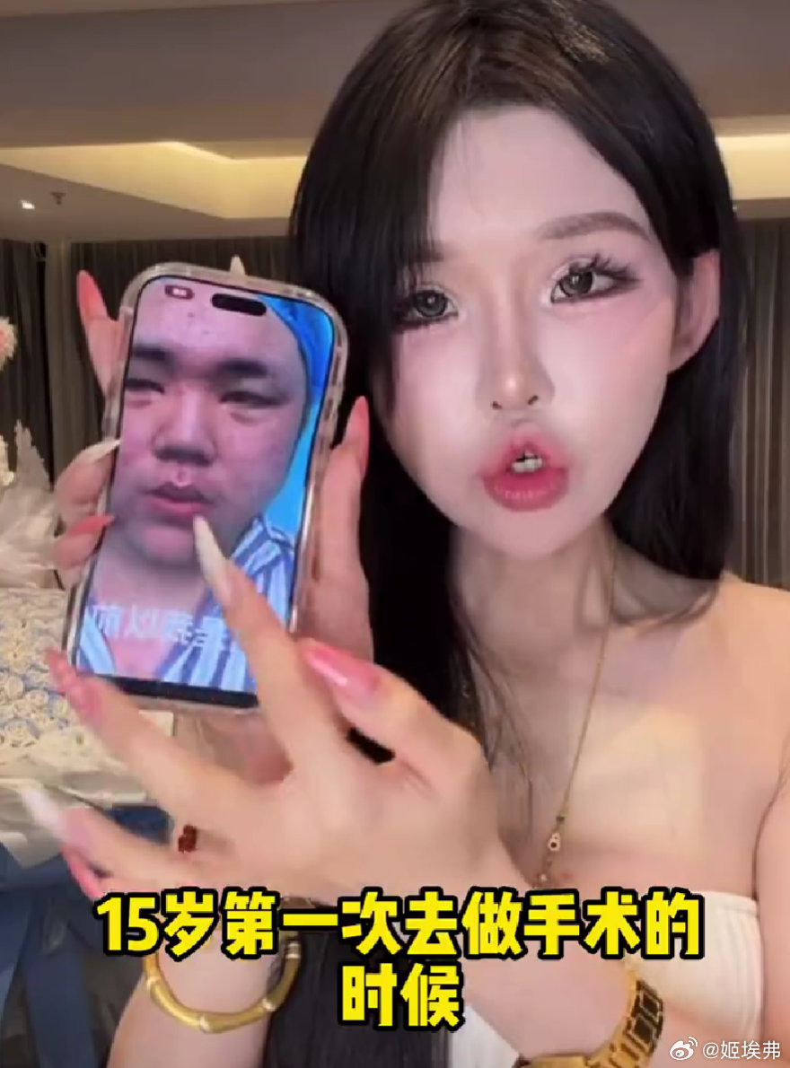 珍妮佛梓刚做完精灵耳把小孩吓哭了精灵耳术后第一天，珍妮佛梓就迫不及待出门喝粥，没