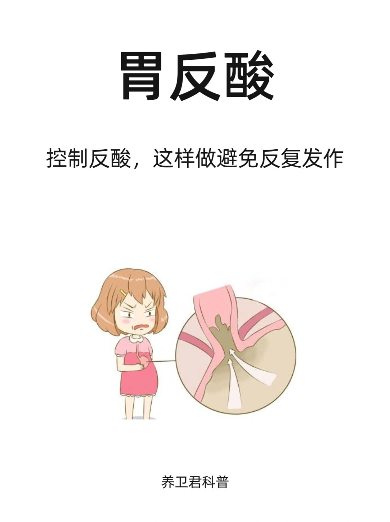 控制反酸，有效避免反复发作