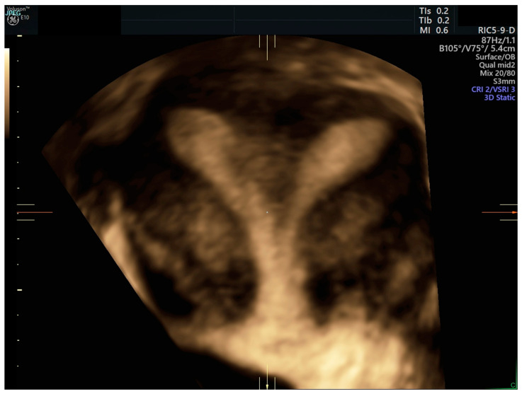 #原来兔子有两个独立的子宫#其实，有极小比例的人类女性也有双子宫，uterus 
