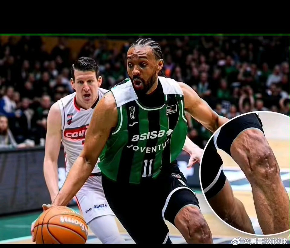 nba 3月13日讯 美媒Buzz晒出了贾巴里·帕克膝盖的近况图，沟壑一般的手术