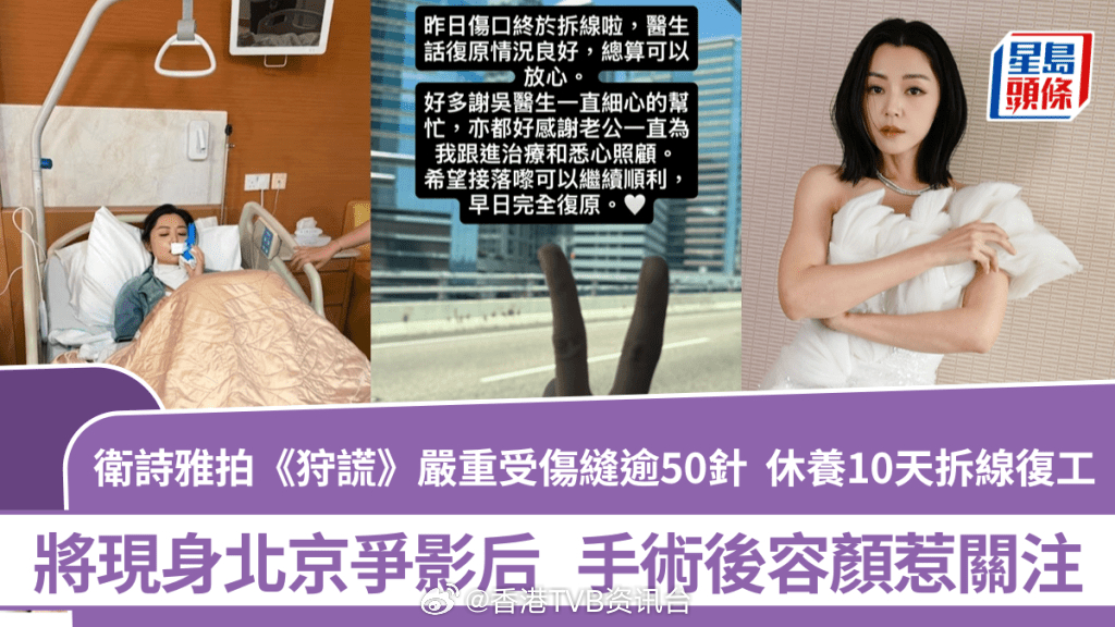 卫诗雅拍《狩谎》严重受伤缝逾50针 休养10天拆线复工将现身北京 手术后容颜惹关