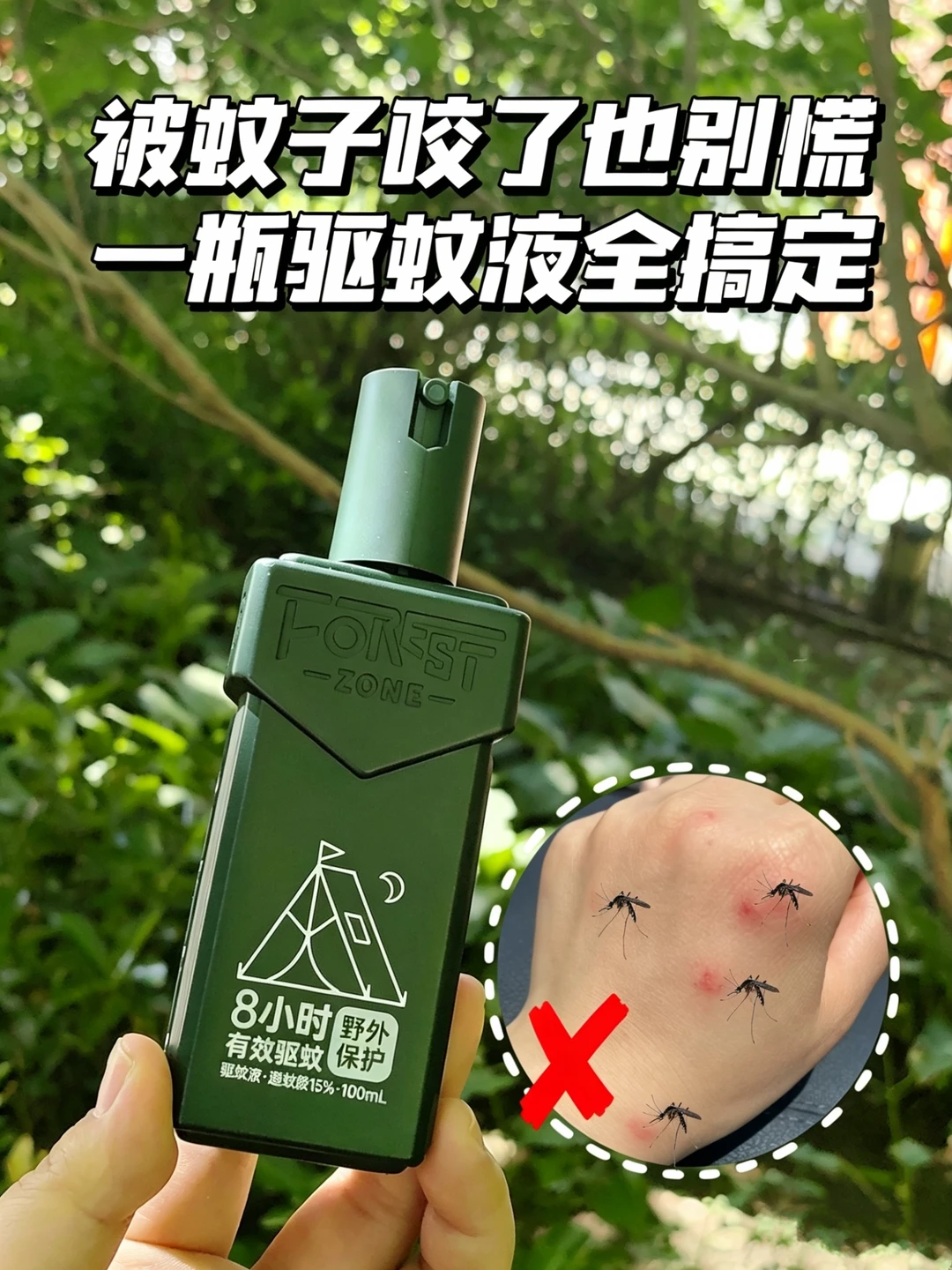 被蚊子咬了怎么消肿止痒？一瓶搞定